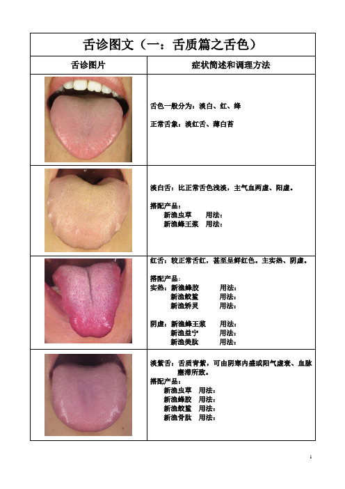 舌诊图文—新渔