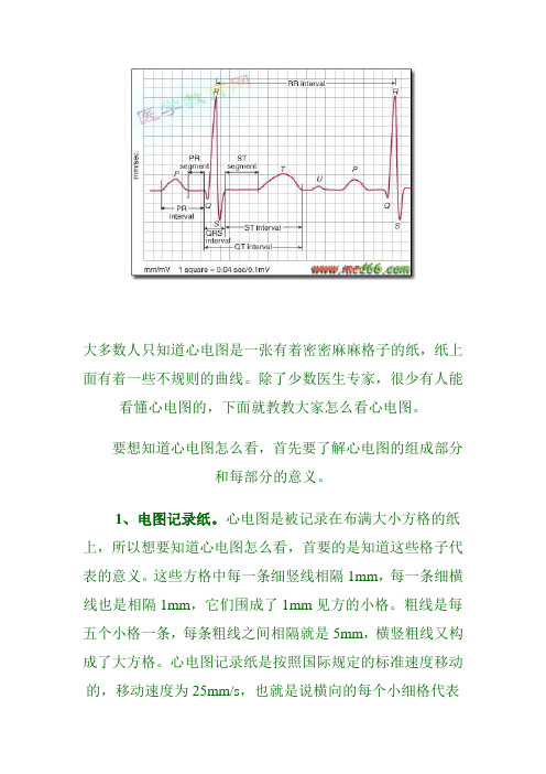 大多数人只知道心电图是一张有着密密麻麻格子的纸