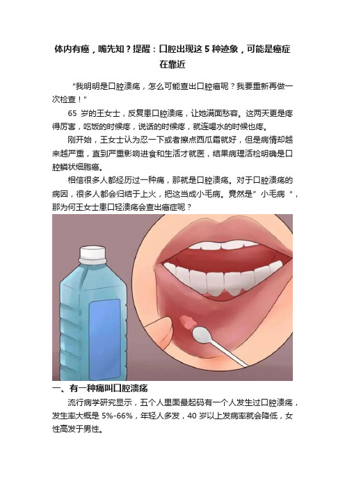 体内有癌，嘴先知？提醒：口腔出现这5种迹象，可能是癌症在靠近