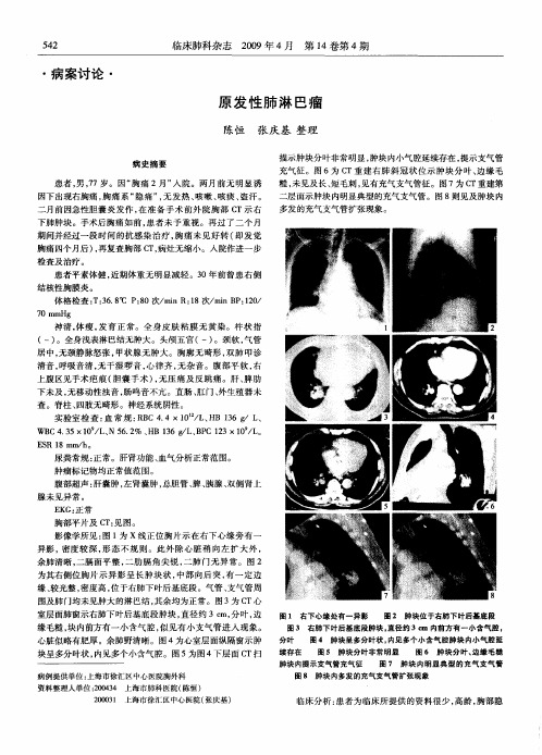 原发性肺淋巴瘤