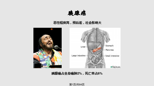 胰腺癌讲课幻灯PPT课件