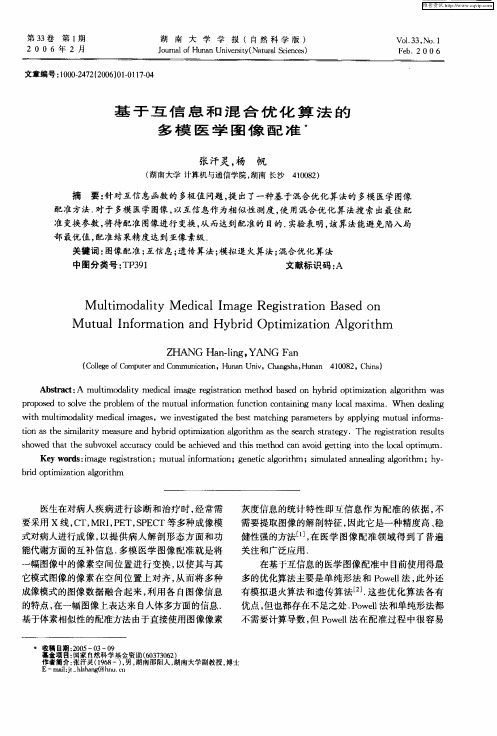 基于互信息和混合优化算法的多模医学图像配准