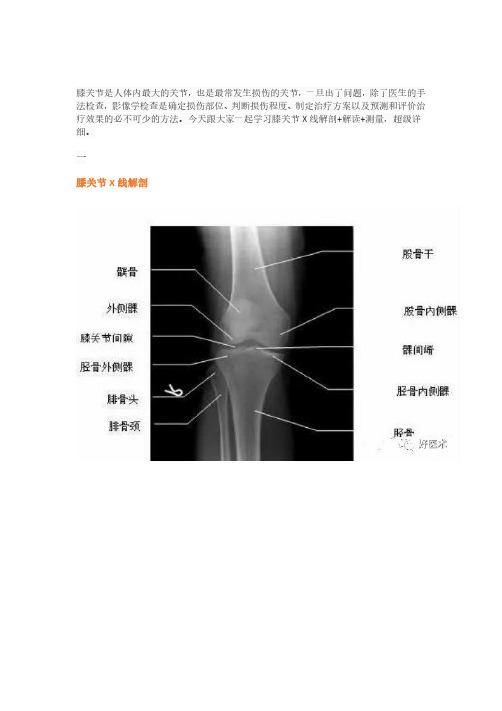 超详细的膝关节X线解剖及测量