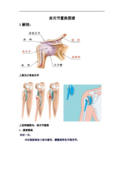 肩关节置换图谱3