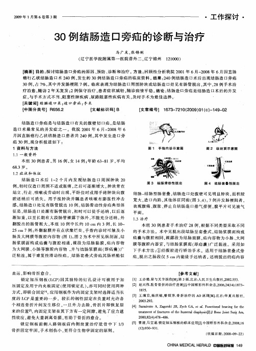 30例结肠造口旁疝的诊断与治疗