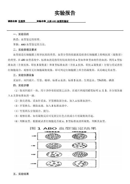 人体ABO血型鉴定实验报告