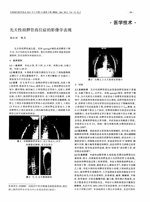 先天性肩胛骨高位症的影像学表现