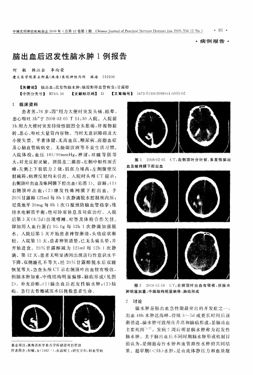 脑出血后迟发性脑水肿1例报告