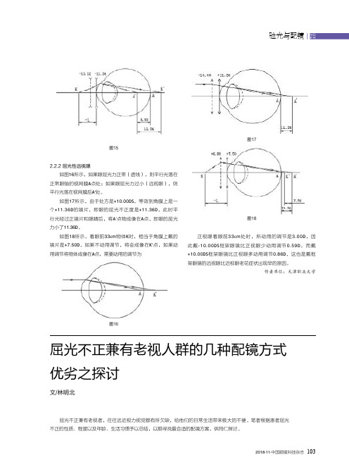 屈光不正兼有老视人群的几种配镜方式优劣之探讨