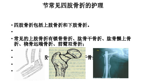 常见四肢骨折护理