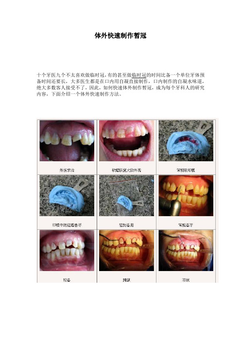 体外快速制作暂冠