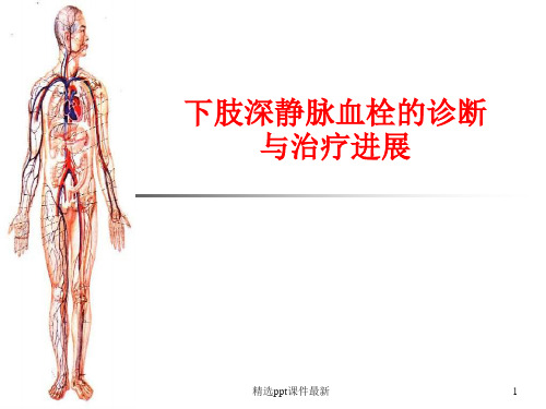 下肢深静脉血栓的诊断与治疗进展PPT课件