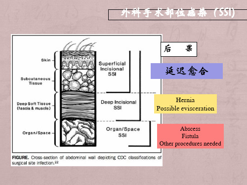 5-I类切口手术预防使用抗菌药物