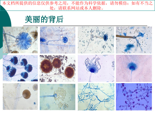 侵袭性真菌感染诊疗和治疗培训课件