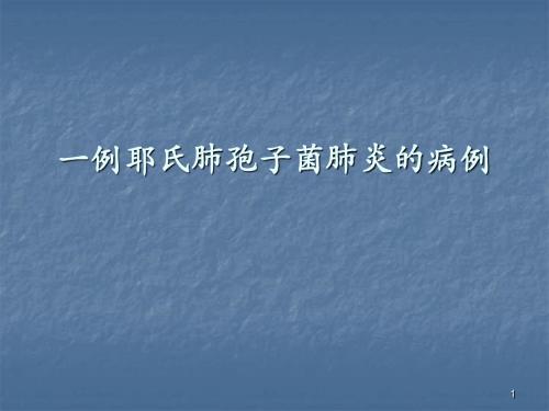 卡氏肺孢子菌肺炎病例汇报ppt课件