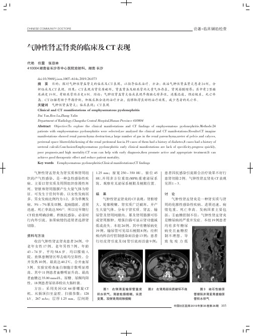 气肿性肾盂肾炎的临床及CT表现
