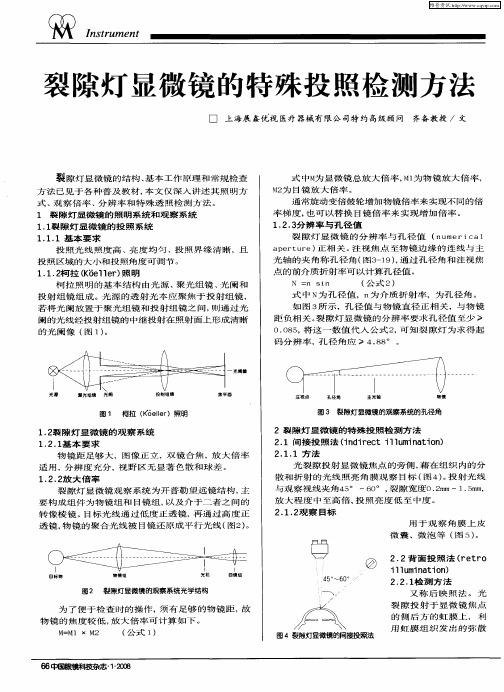 裂隙灯显微镜的特殊投照检测方法