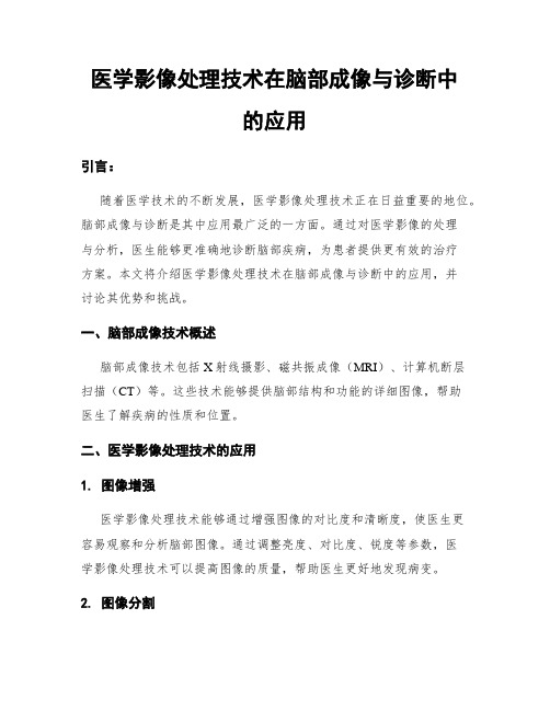 医学影像处理技术在脑部成像与诊断中的应用