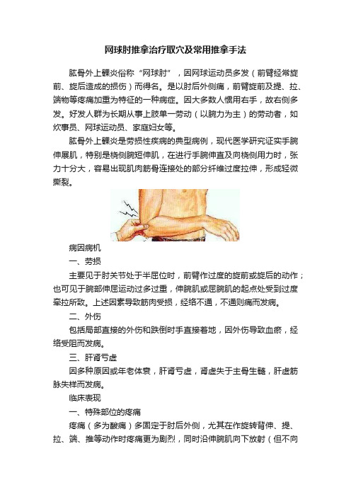 网球肘推拿治疗取穴及常用推拿手法