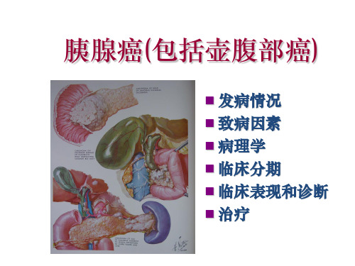 胰腺癌ppt