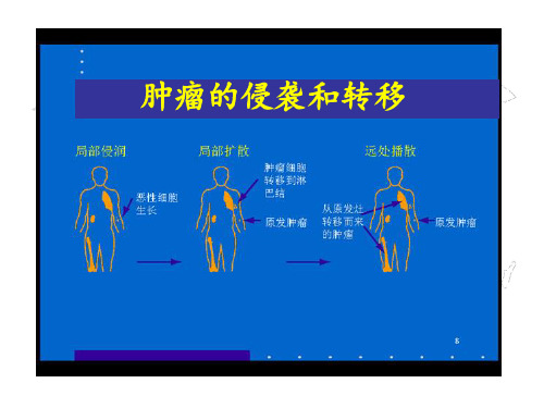 肿瘤分子生物学-侵袭转移