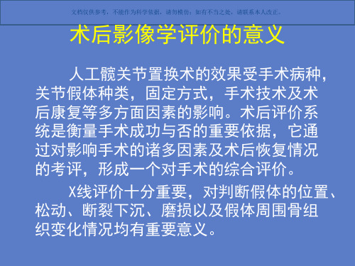髋膝关节置换术后X线评价课件