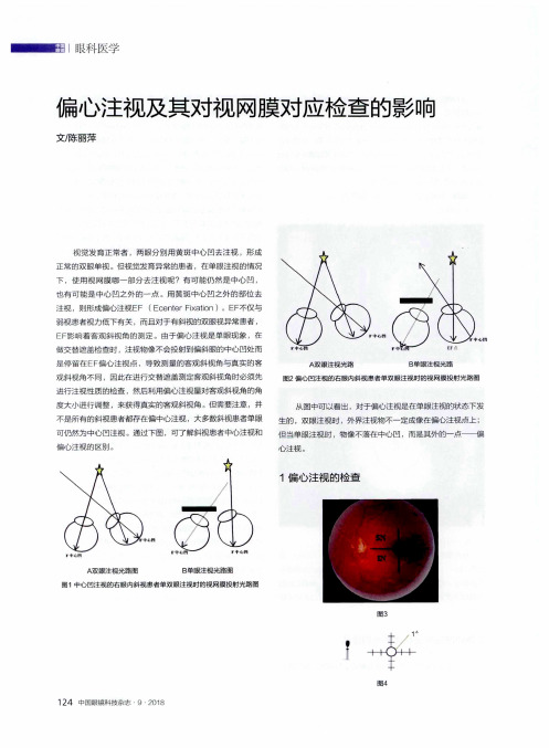 偏心注视及其对视网膜对应检查的影响