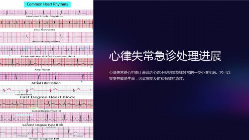心律失常急诊处理进展