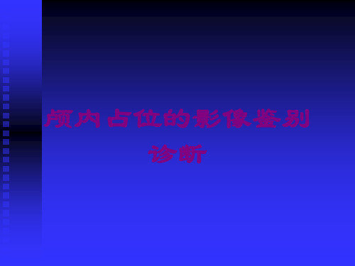 颅内占位的影像鉴别诊断课件