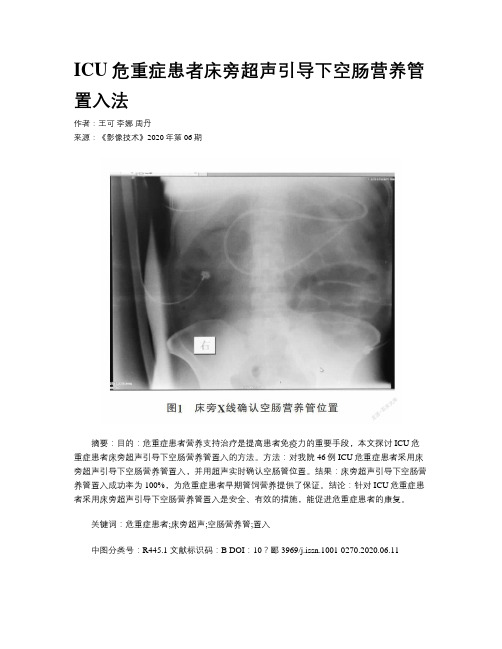 ICU危重症患者床旁超声引导下空肠营养管置入法