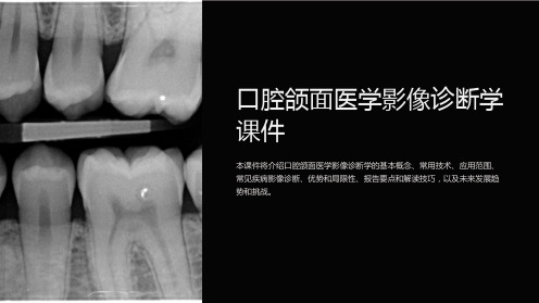 口腔颌面医学影像诊断学课件