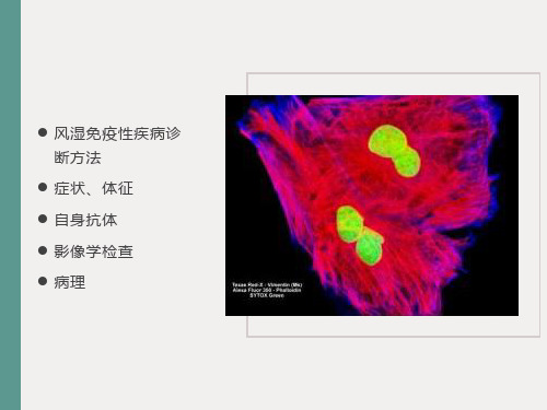 抗核抗体检测及临床意义