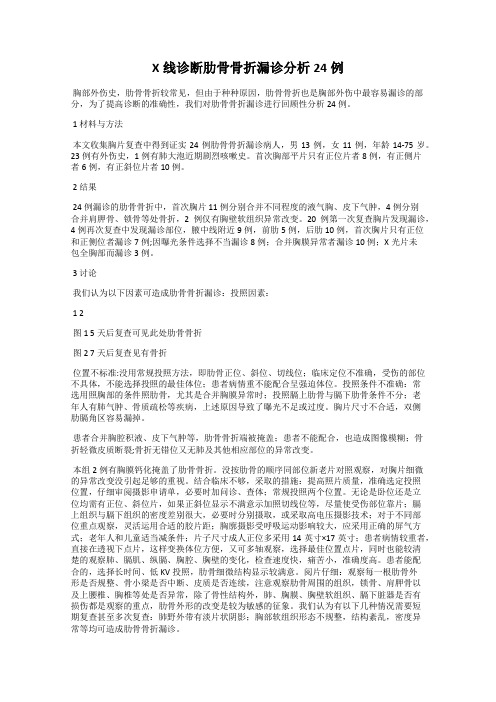 X线诊断肋骨骨折漏诊分析24例