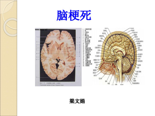 颅脑ct诊断(1)