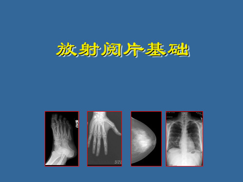 (医学课件)放射阅片基础学生PPT演示课件