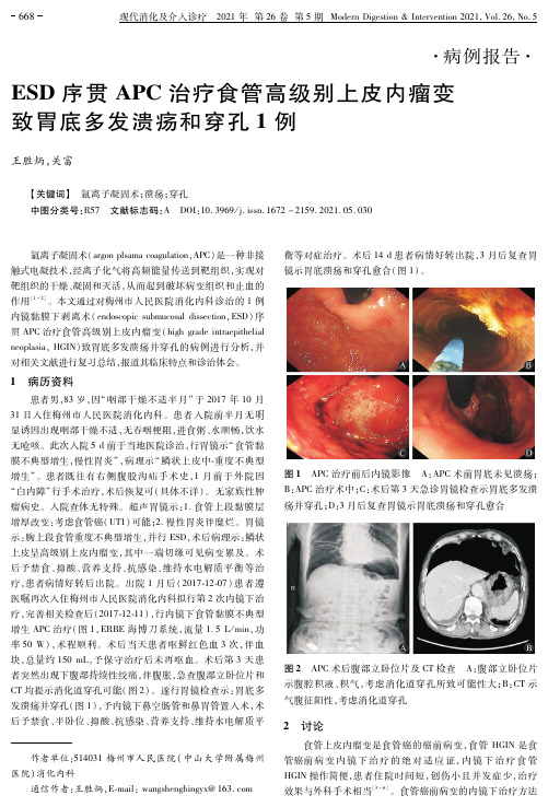 ESD序贯APC治疗食管高级别上皮内瘤变致胃底多发溃疡和穿孔1例