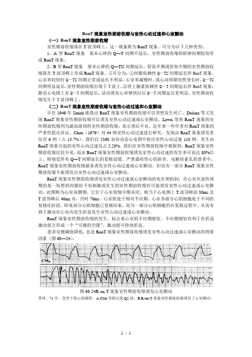 Ron现象室性期前收缩与室性心动过速和心室颤动