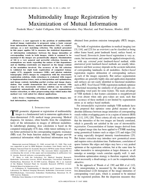 Multimodality Image Registration by Maximization of Mutual Information