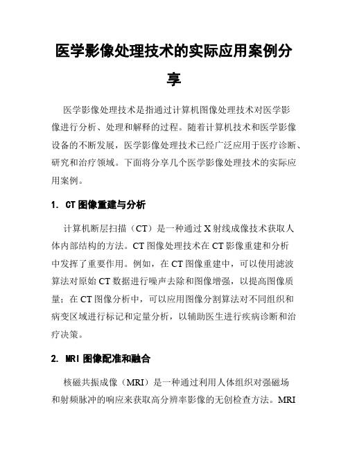 医学影像处理技术的实际应用案例分享