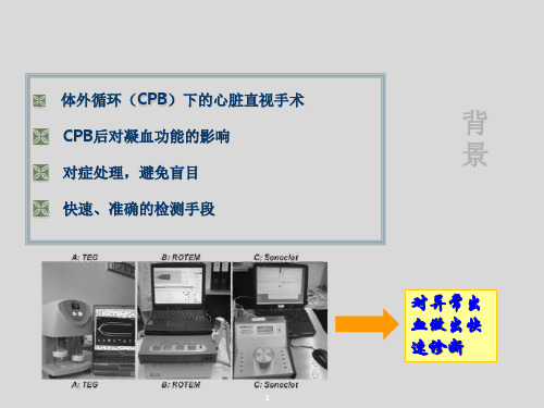 Sonoclot的临床应用及案例分析