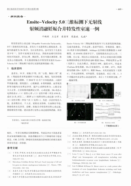 Ensite-Velocity 5.0三维标测下无射线射频消融妊娠合并特发性室速一例