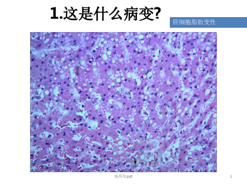 病理切片考试复习PPT课件