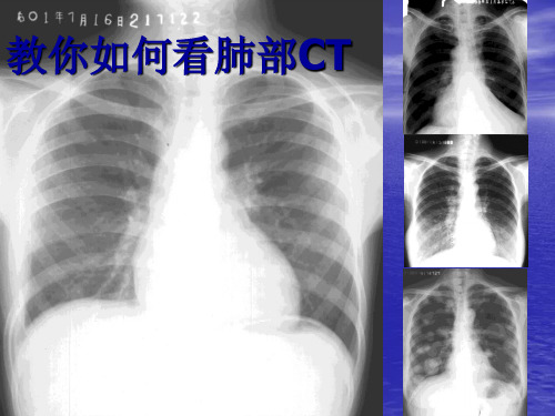 教你如何看肺部CT ppt课件