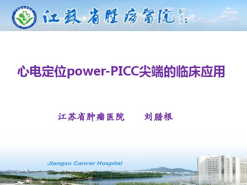 超声引导power-picc的临床应用