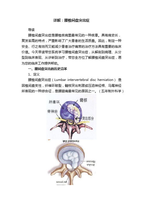 详解：腰椎间盘突出症