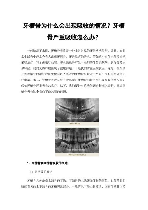 牙槽骨为什么会出现吸收的情况？牙槽骨严重吸收怎么办？