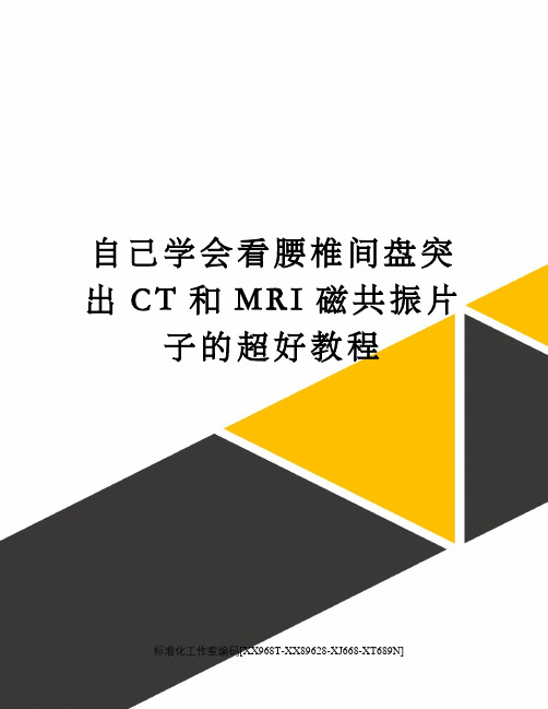 自己学会看腰椎间盘突出CT和MRI磁共振片子的超好教程