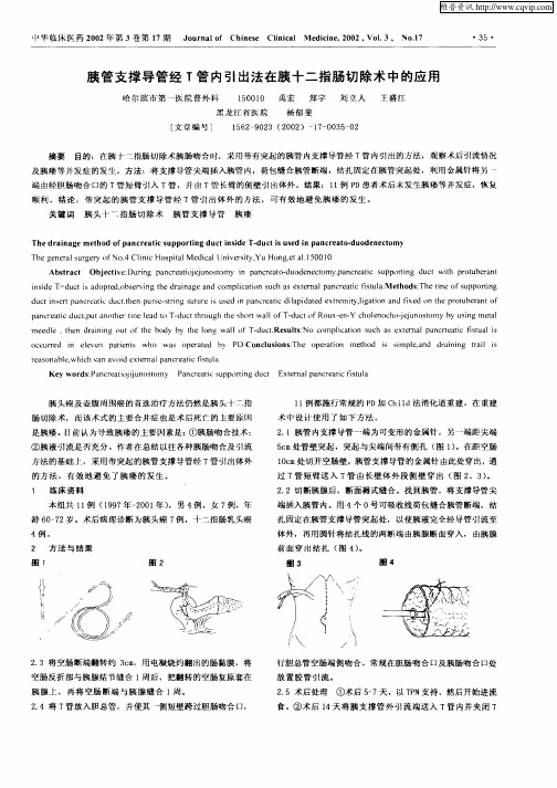 胰管支撑导管经T管内引出法在胰十二指肠切除术中的应用