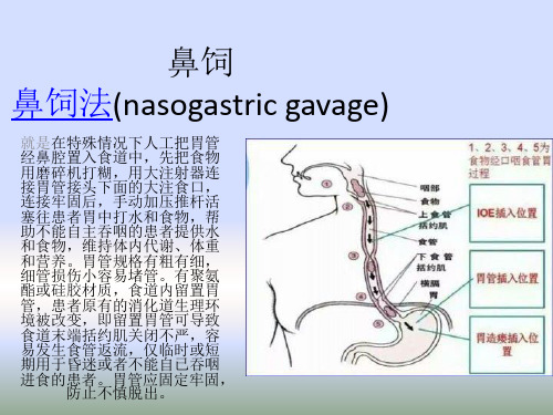 鼻饲 PPT