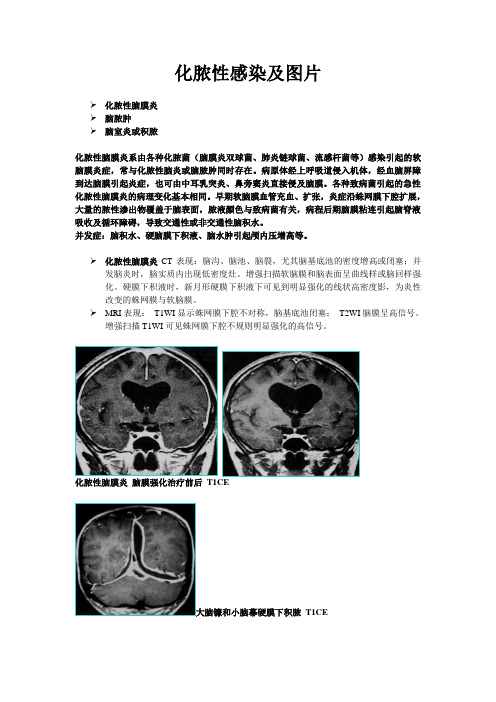 化脓性感染及影像图片